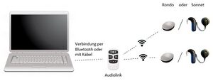 Schematische Darstellung einer technischen Anbindung für eine Videokonferenz bei bilateraler Versorgung mit CI's von MED-EL. Der Audiolink ist entweder per Bluetooth oder mit dem Kabel mit dem Laptop verbunden. Die Prozessoren (Rondo oder Sonnet) sind per Funk mit dem Audiolink gekoppelt.