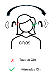 Grafik mit Kopf, der auf einer Seite ein rotes Kreuz an Stelle des Ohrs hat, das die Taubheit symbolisiert. Auf der anderen Seite ein grünes Häkchen, das das gute Ohr symbolisiert. Ein Pfeil vom Kreuz zum Häkchen.